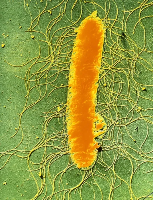 Gerahmter Druck : Proteus mirabilis Bakterium Gerahmter Druck : Proteus mirabilis Bakterium