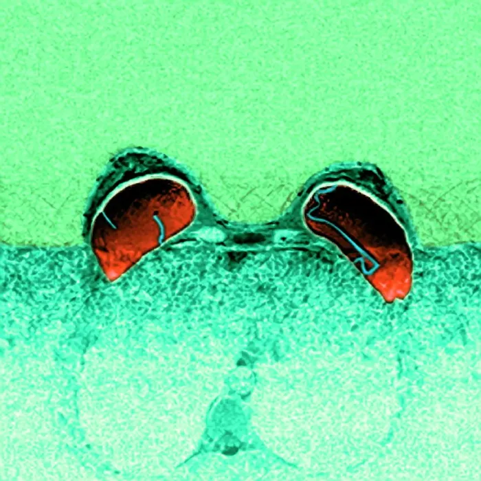 Gerahmter Druck : Klatschende Brustimplantate, MRI Gerahmter Druck : Klatschende Brustimplantate, MRI