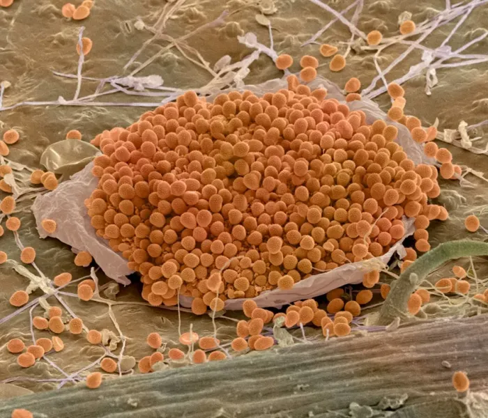 Gerahmter Druck : Rot Pilz, SEM Gerahmter Druck : Rot Pilz, SEM