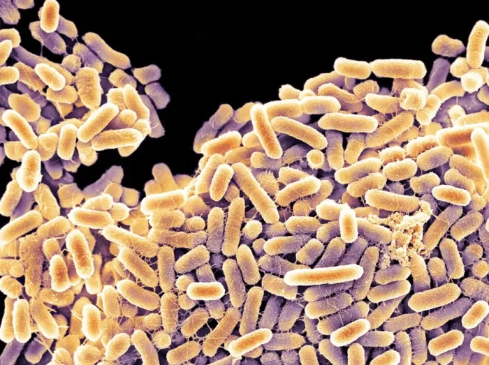 Gerahmter Druck : Salmonellen Bakterien im SEM Gerahmter Druck : Salmonellen Bakterien im SEM