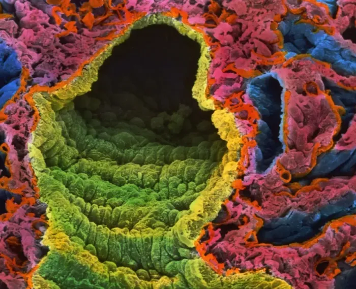 Gerahmter Druck : Lungenalveolenschema Gerahmter Druck : Lungenalveolenschema