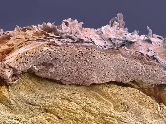 Gerahmter Druck : Skin, SEM. Die Haut. Farbige Rasterelektronenmikroskopaufnahme einer Schnittstelle Gerahmter Druck : Skin, SEM. Die Haut. Farbige Rasterelektronenmikroskopaufnahme einer Schnittstelle
