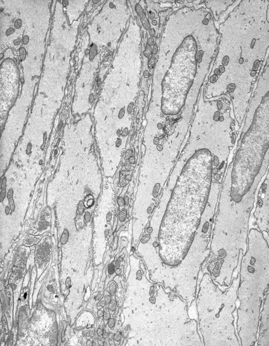 Gerahmter Druck : Weichmuskeltissue, TEM Gerahmter Druck : Weichmuskeltissue, TEM