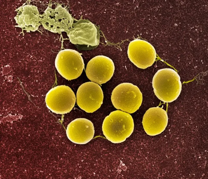Gerahmter Druck : Staphylococcus aureus Bakterien, SEM C017 / 7138 Gerahmter Druck : Staphylococcus aureus Bakterien, SEM C017 / 7138