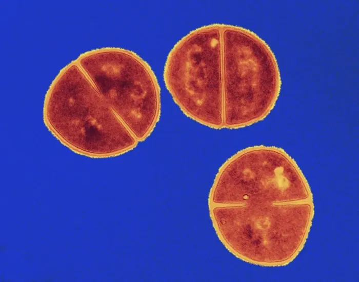 Gerahmter Druck : Staphylococcus aureus Bakterien, TEM C016 / 9455 Gerahmter Druck : Staphylococcus aureus Bakterien, TEM C016 / 9455