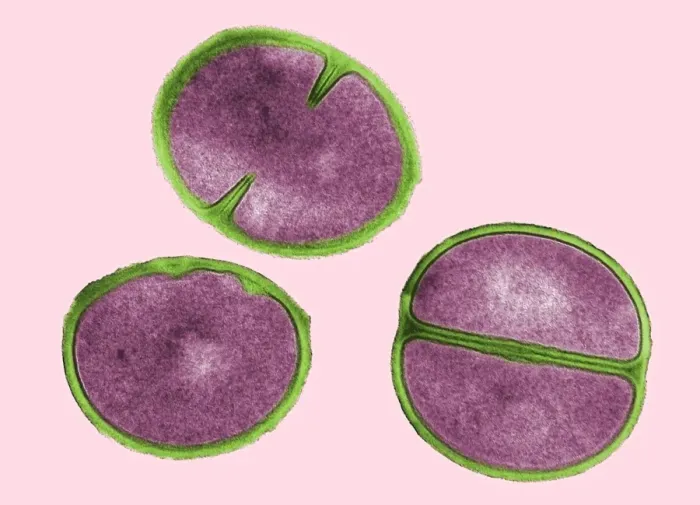 Gerahmter Druck : Staphylococcus aureus teilt sich ab, TEM Gerahmter Druck : Staphylococcus aureus teilt sich ab, TEM