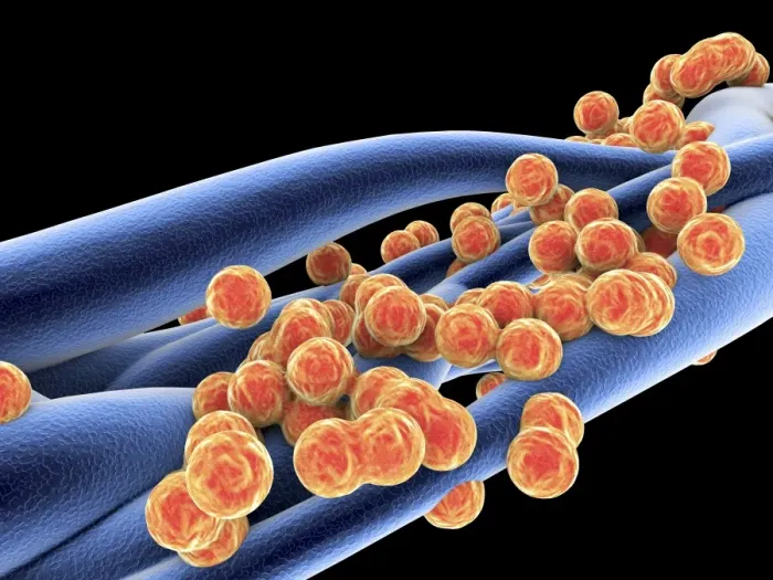 Gerahmter Druck : Staphylococcus aureus MRSA Bakterien Gerahmter Druck : Staphylococcus aureus MRSA Bakterien