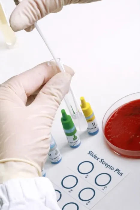 Gerahmter Druck : Streptococcus Gruppentest C013 / 8758 Gerahmter Druck : Streptococcus Gruppentest C013 / 8758