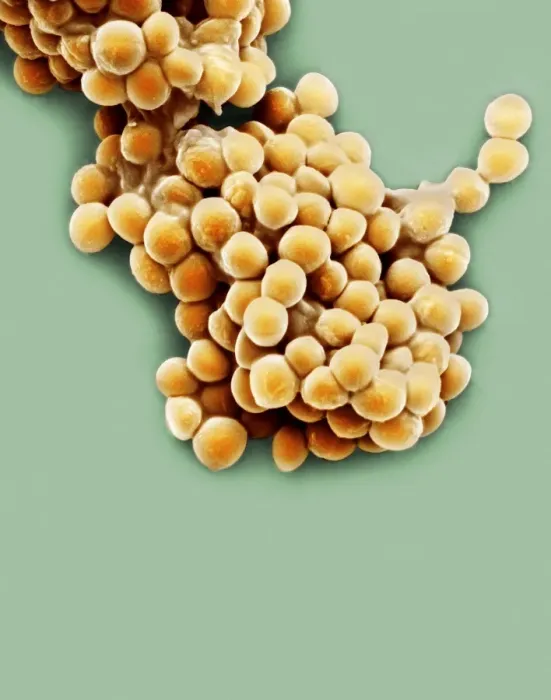 Gerahmter Druck : Streptococcus thermophilus Bakterien, SEM Gerahmter Druck : Streptococcus thermophilus Bakterien, SEM