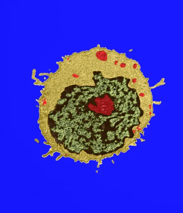 Gerahmter Druck : T-Lymphozyt, TEM Gerahmter Druck : T-Lymphozyt, TEM