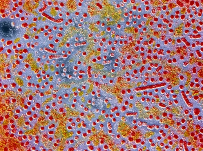 Gerahmter Druck : Hepatitis B-Viruspartikel Gerahmter Druck : Hepatitis B-Viruspartikel
