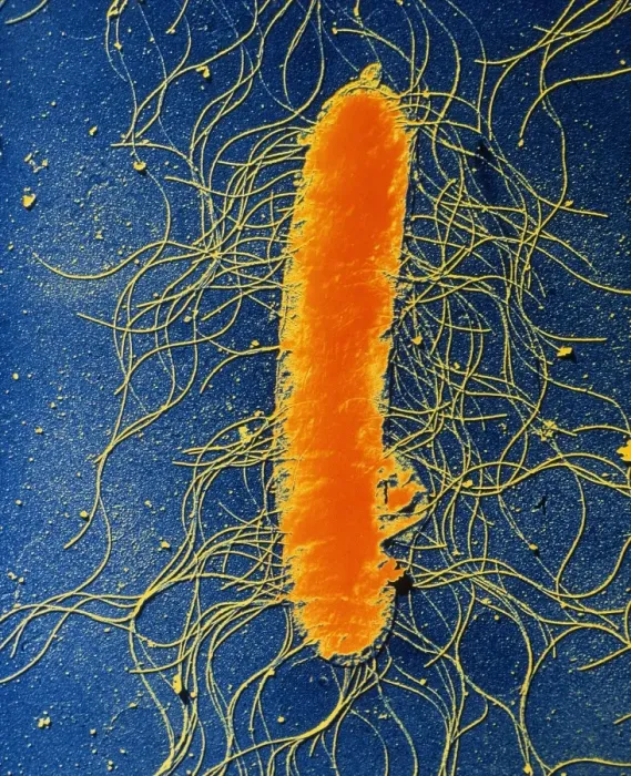 Gerahmter Druck : Proteusmirabilibacter TEM Gerahmter Druck : Proteusmirabilibacter TEM