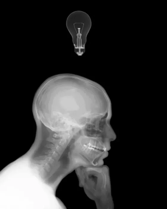 Gerahmter Druck : Denkender Mann mit einer Licht bulb Gerahmter Druck : Denkender Mann mit einer Licht bulb