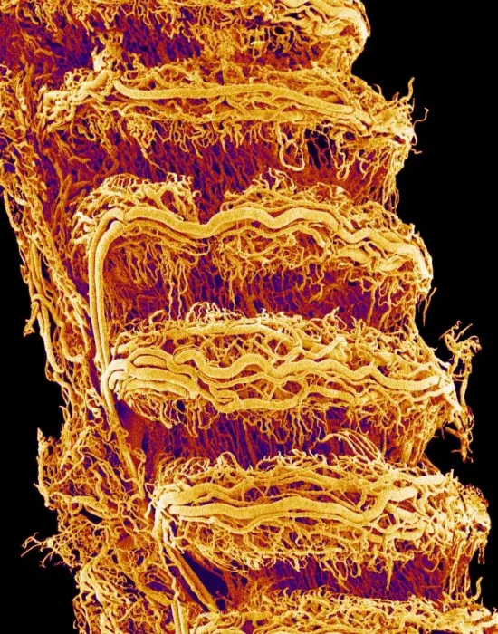 Gerahmter Druck : Trachea. Farbige Rastertunnelmikroskopie (SEM) der Äußere Oberfläche des Trachens 