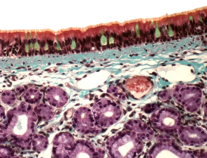 Gerahmter Druck : Trachea, Lichtmikroskop Gerahmter Druck : Trachea, Lichtmikroskop