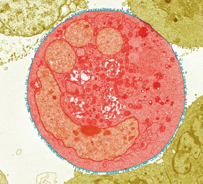 Gerahmter Druck : Vezikuläre Stomatisitatsvirus, TEM Gerahmter Druck : Vezikuläre Stomatisitatsvirus, TEM