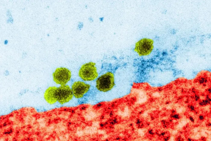 Gerahmter Druck : West-Nil- Virus, TEM Gerahmter Druck : West-Nil- Virus, TEM