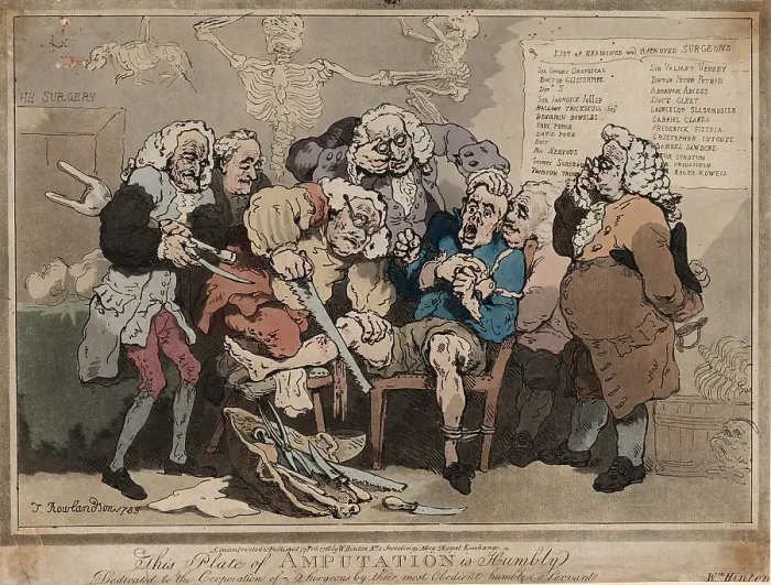 Gerahmter Druck : Zeichnungen Drucke, Druck, Amputation, Künstler, Verleger, Thomas Rowlandson, William Hinton Gerahmter Druck : Zeichnungen Drucke, Druck, Amputation, Künstler, Verleger, Thomas Rowlandson, William Hinton