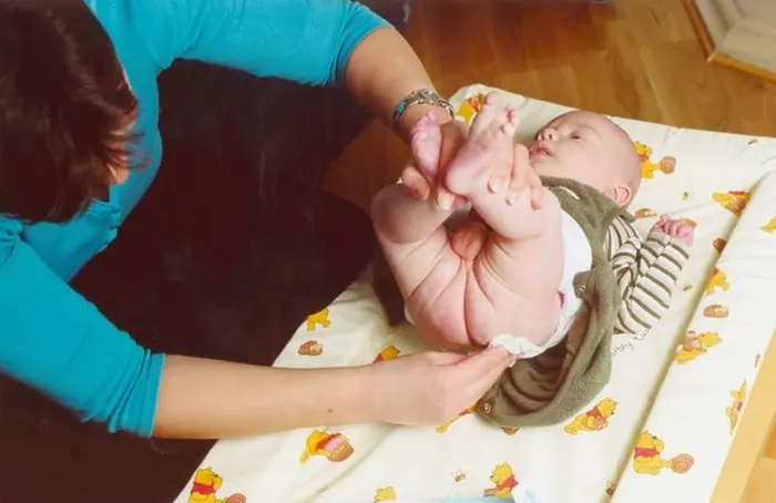 Gerahmter Druck : Die Windel des Babys wechseln. Gerahmter Druck : Die Windel des Babys wechseln.