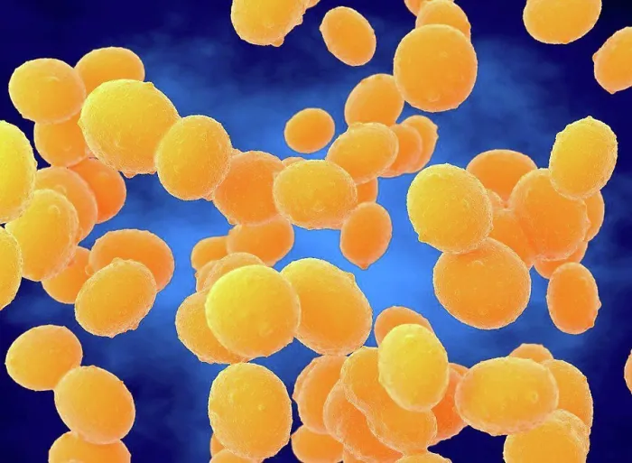 Gerahmter Druck : Staphylococcus aureus (MRSA)-Bakterien, Illustration.