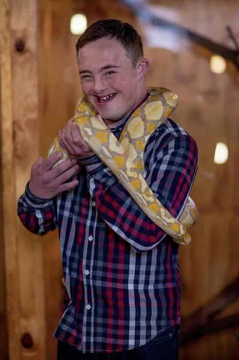 Gerahmter Druck : Jüngerer Mann mit Down-Syndrom hält albinosen Python-Schlangen. Gerahmter Druck : Jüngerer Mann mit Down-Syndrom hält albinosen Python-Schlangen.