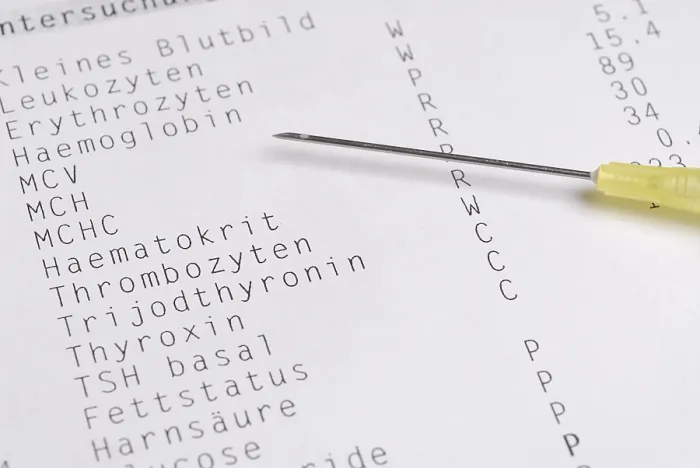 Gerahmter Druck : Analyse eines Bluttests Gerahmter Druck : Analyse eines Bluttests