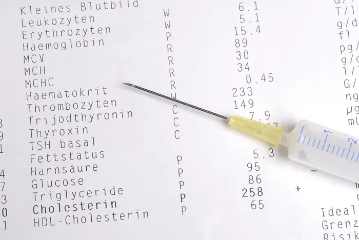 Gerahmter Druck : Analyse eines Bluttests. Gerahmter Druck : Analyse eines Bluttests.