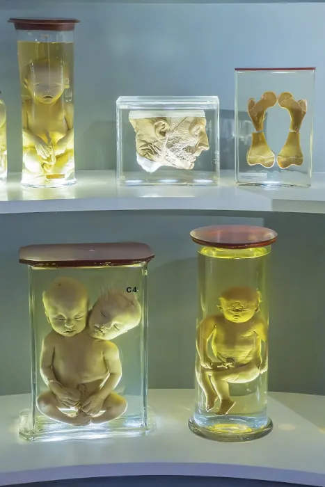 Gerahmter Druck : Anatomische Sammlung, Präparate. Gerahmter Druck : Anatomische Sammlung, Präparate.