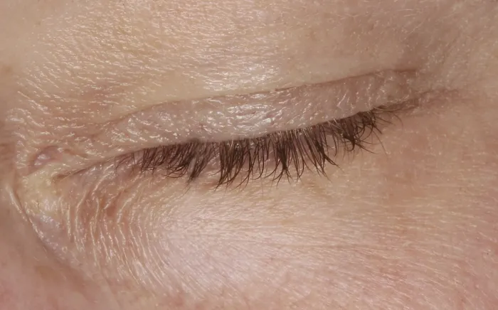 Gerahmter Druck : Geschlossenes Auge. Gerahmter Druck : Geschlossenes Auge.