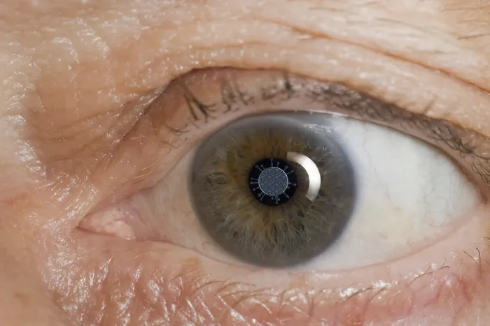 Gerahmter Druck : Ein Coronavirus spiegelt sich in einem Auge. Gerahmter Druck : Ein Coronavirus spiegelt sich in einem Auge.