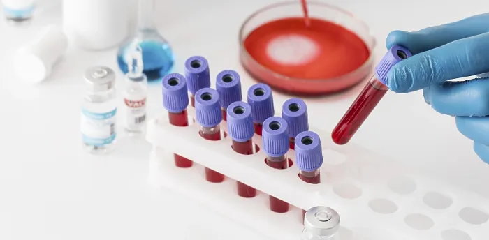 Gerahmter Druck : Coronavirus-Impfstoff-Labor mit Proben Gerahmter Druck : Coronavirus-Impfstoff-Labor mit Proben