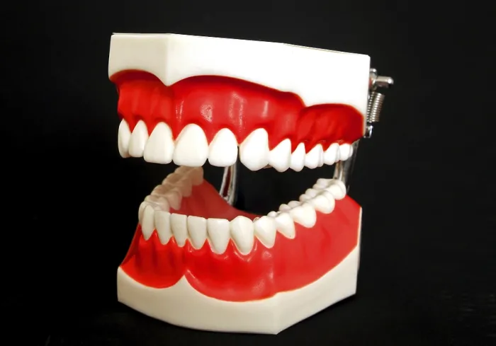 Gerahmter Druck : Zahnersatzmodell Gerahmter Druck : Zahnersatzmodell