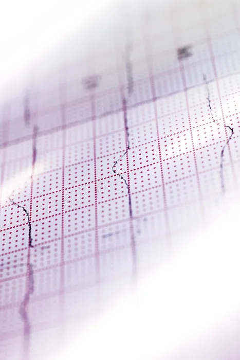 Gerahmter Druck : Elektrokardiogramm (ECG oder EKG) Gerahmter Druck : Elektrokardiogramm (ECG oder EKG)