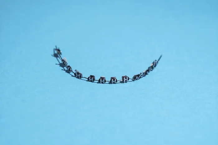 Gerahmter Druck : Festbrackets eines Kindes auf blauer Hintergrund Gerahmter Druck : Festbrackets eines Kindes auf blauer Hintergrund