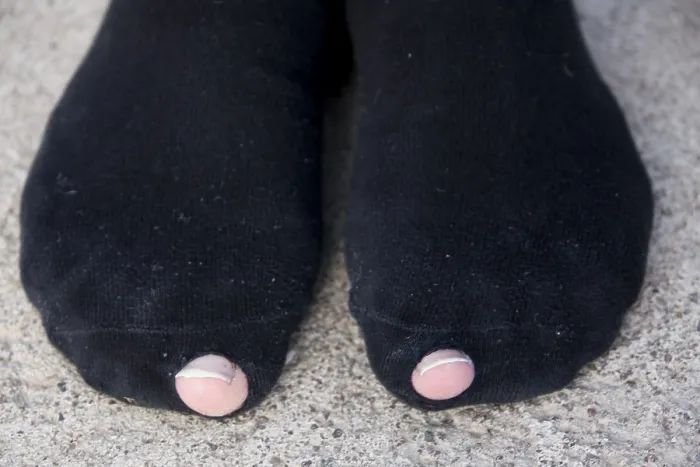 Gerahmter Druck : Löcher in Socken Gerahmter Druck : Löcher in Socken