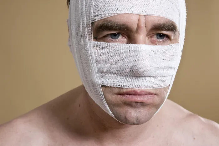 Gerahmter Druck : Mann mit verbundener Gesichtshaut Gerahmter Druck : Mann mit verbundener Gesichtshaut