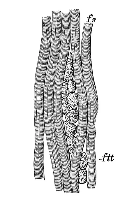 Gerahmter Druck : Muskel, anatomische Illustration Gerahmter Druck : Muskel, anatomische Illustration