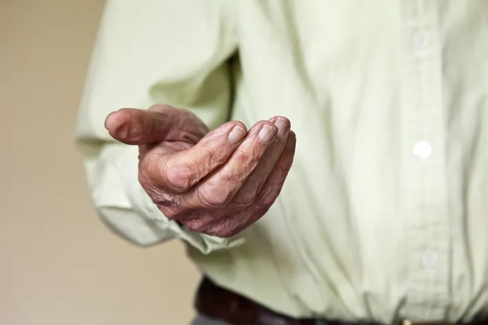Gerahmter Druck : Offene Hand eines alten Mannes, achtzig Jahre. Gerahmter Druck : Offene Hand eines alten Mannes, achtzig Jahre.