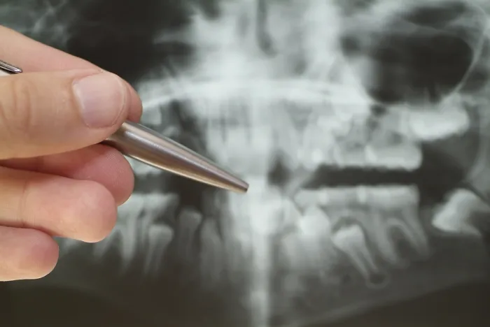 Gerahmter Druck : Radiograph Gerahmter Druck : Radiograph