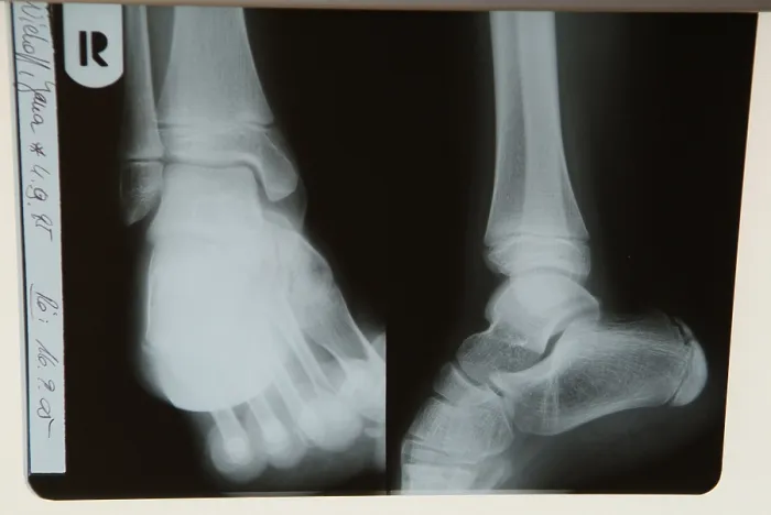 Gerahmter Druck : Radiograph Gerahmter Druck : Radiograph