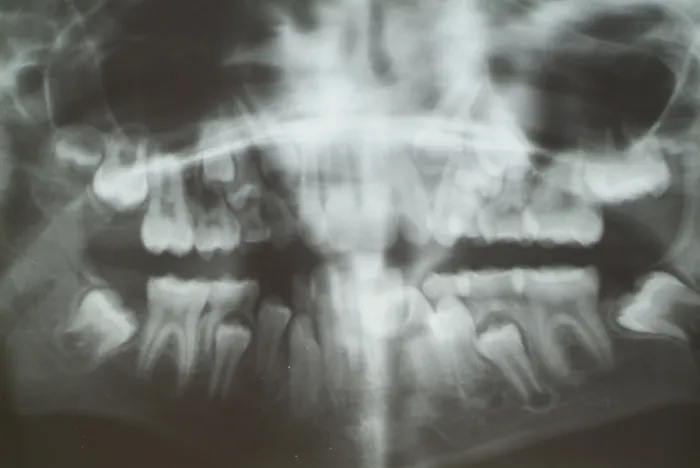 Gerahmter Druck : Radiograph Gerahmter Druck : Radiograph