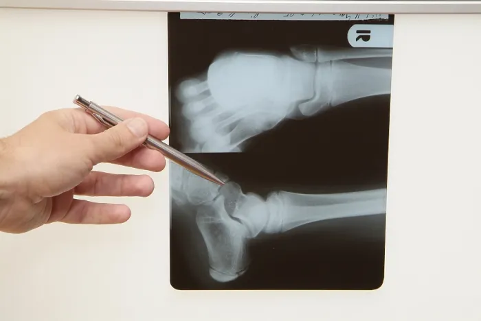 Gerahmter Druck : Radiograph Gerahmter Druck : Radiograph