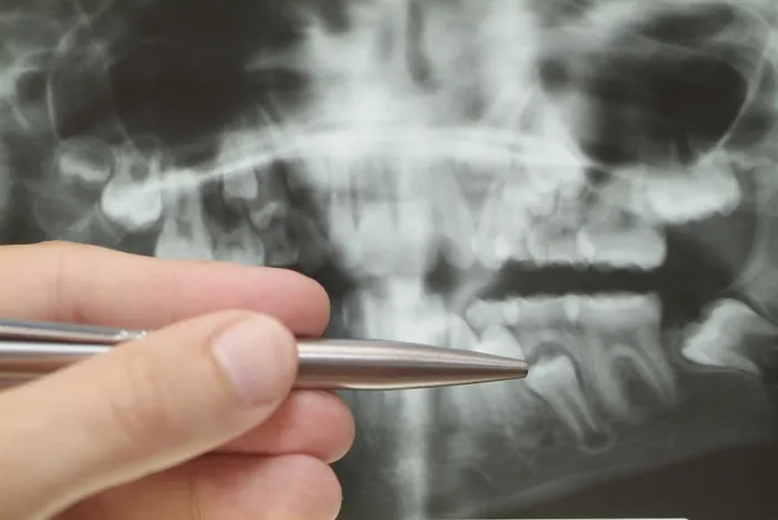 Gerahmter Druck : Radiograph Gerahmter Druck : Radiograph