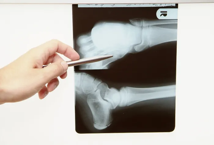Gerahmter Druck : Radiograph Gerahmter Druck : Radiograph