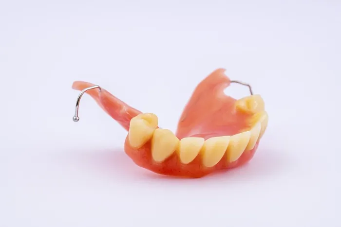 Gerahmter Druck : Entfernbare Oberkieferprothese. Gerahmter Druck : Entfernbare Oberkieferprothese.