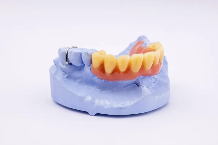 Gerahmter Druck : Obere Zahnprothese. Gerahmter Druck : Obere Zahnprothese.