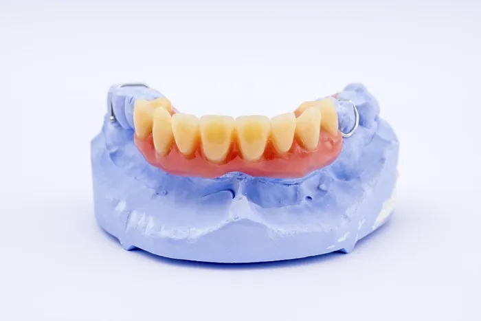Gerahmter Druck : Obere Zahnprothese Gerahmter Druck : Obere Zahnprothese