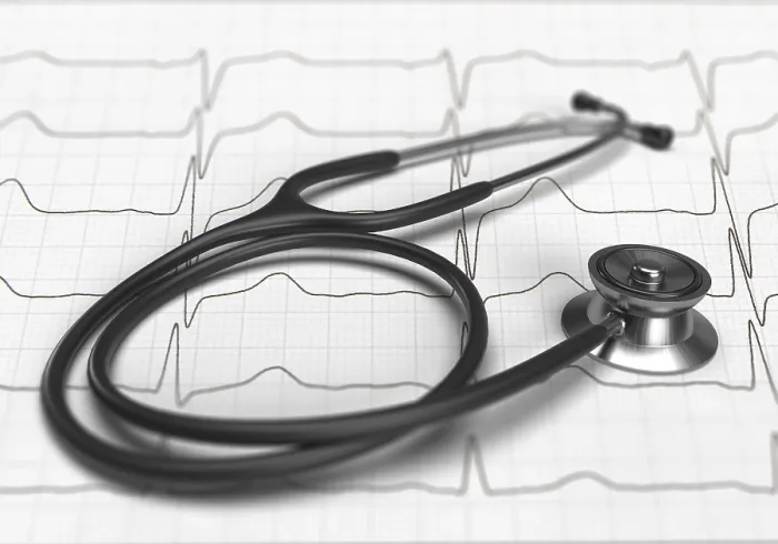 Gerahmter Druck : Stethoskop auf EKG Gerahmter Druck : Stethoskop auf EKG