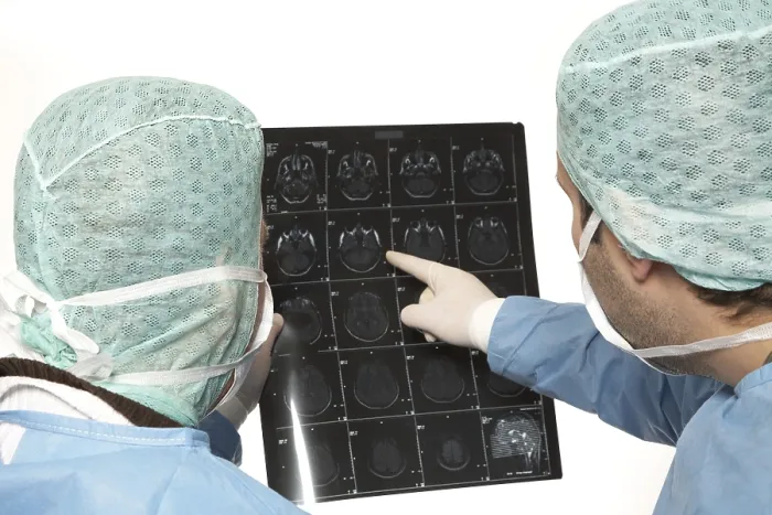 Gerahmter Druck : Team von Ärzten analysiert ein CT- oder CAT-Schattenraum-Bild. Gerahmter Druck : Team von Ärzten analysiert ein CT- oder CAT-Schattenraum-Bild.