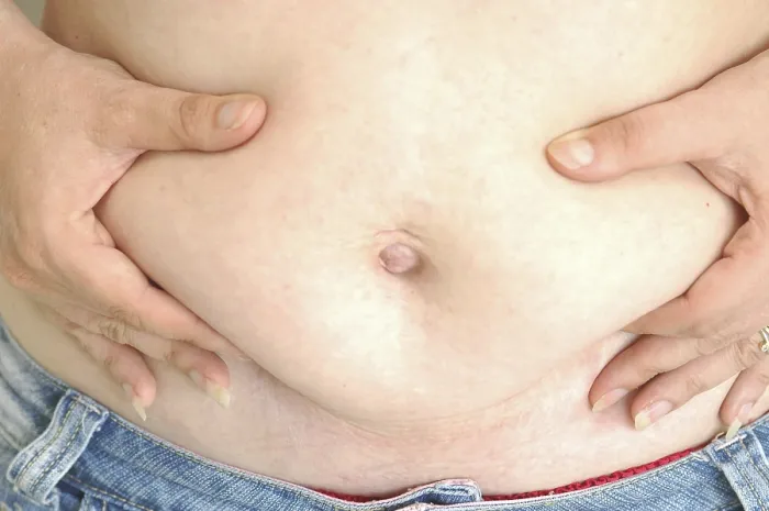 Gerahmter Druck : Dicke Bauch. Gerahmter Druck : Dicke Bauch.